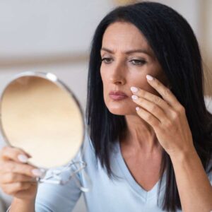 Blefaroplastia Inferior